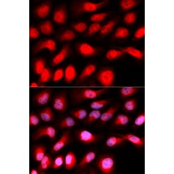 Zinc Finger E-Box-Binding Homeobox 1 (ZEB1) Antibody