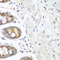 Vascular Endothelial Growth Factor Receptor 3 (FLT4) Antibody