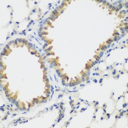 Vascular Endothelial Growth Factor Receptor 3 (FLT4) Antibody