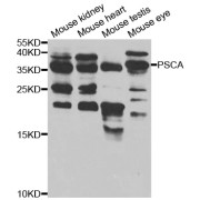 Western blot analysis of extracts of various cell lines, using PSCA antibody (abx004291) at 1/1000 dilution.