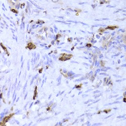 Lymphocyte Specific Protein 1 (LSP1) Antibody