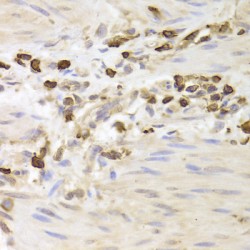 Lymphocyte Specific Protein 1 (LSP1) Antibody