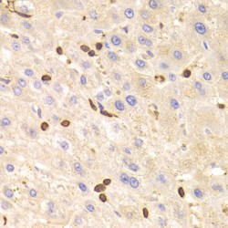 Lymphocyte Specific Protein 1 (LSP1) Antibody