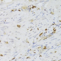 Lymphocyte Specific Protein 1 (LSP1) Antibody