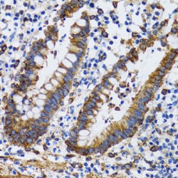 Membrane-Associated Progesterone Receptor Component 1 (PGRMC1) Antibody