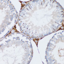 Membrane-Associated Progesterone Receptor Component 1 (PGRMC1) Antibody