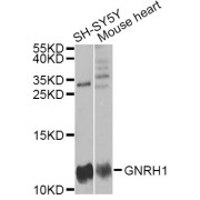 Western blot analysis of extracts of various cell lines, using Pro-GNRH1 antibody (abx004300) at 1/1000 dilution.