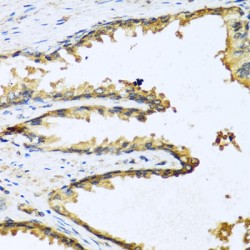 Progonadoliberin 1 (GNRH1) Antibody