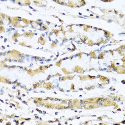 Progonadoliberin 1 (GNRH1) Antibody