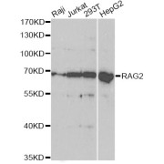 Western blot analysis of extracts of various cell lines, using RAG2 antibody (abx004301) at 1/1000 dilution.