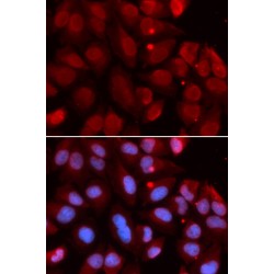 Recombination Activating Gene 2 (RAG2) Antibody