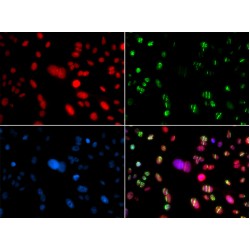 Recombination Activating Gene 2 (RAG2) Antibody