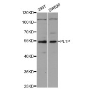 Western blot analysis of extracts of various cell lines, using PLTP antibody (abx004303) at 1/1000 dilution.