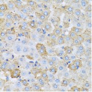 Immunohistochemistry of paraffin-embedded rat liver using APOC1 antibody (abx004304) at dilution of 1/100 (40x lens).