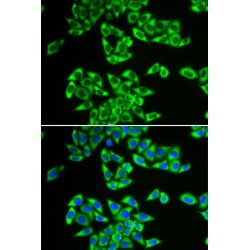 DEAD-Box Helicase 3, X-Linked (DDX3X) Antibody