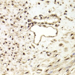 FK506 Binding Protein 4 (FKBP4) Antibody