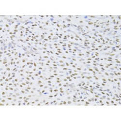 FK506 Binding Protein 4 (FKBP4) Antibody