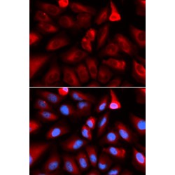 FK506 Binding Protein 4 (FKBP4) Antibody