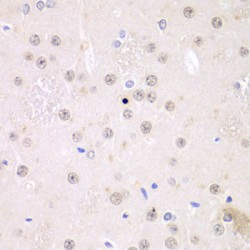 Fragile X Mental Retardation 1 (FMR1) Antibody