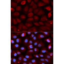 Fragile X Mental Retardation 1 (FMR1) Antibody