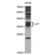 Western blot analysis of extracts of Jurkat cells, using LAT antibody (abx004320) at 1/1000 dilution.