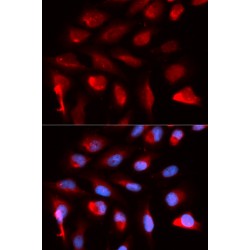 Peroxisome Proliferator Activated Receptor Delta (PPARD) Antibody