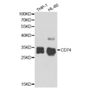 Western blot analysis of extracts of various cell lines, using CD74 antibody (abx004335) at 1/1000 dilution.