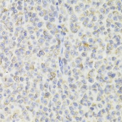 HLA Class II Histocompatibility Antigen Gamma Chain (CD74) Antibody