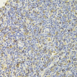 HLA Class II Histocompatibility Antigen Gamma Chain (CD74) Antibody