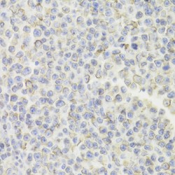 HLA Class II Histocompatibility Antigen Gamma Chain (CD74) Antibody