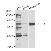 Western blot analysis of extracts of various cell lines, using ATP7B antibody (abx004341) at 1/1000 dilution.