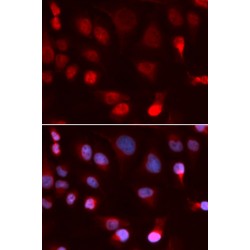 ATPase, Cu++ Transporting Beta Polypeptide (ATP7B) Antibody