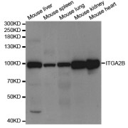 Western blot analysis of extracts of various cell lines, using ITGA2B antibody (abx004343) at 1/1000 dilution.