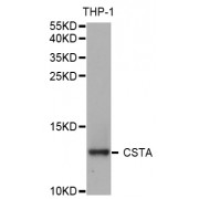 Western blot analysis of extracts of THP-1 cells, using CSTA antibody (abx004348) at 1/1000 dilution.