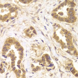 Rho-Associated Protein Kinase 2 (ROCK2) Antibody