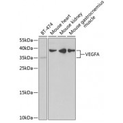 Western blot analysis of extracts of various cell lines, using VEGFA antibody (abx004364) at 1/1000 dilution.