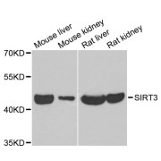 Western blot analysis of extracts of various cell lines, using SIRT3 antibody (abx004372) at 1/1000 dilution.