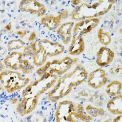 Sirtuin 3 (SIRT3) Antibody