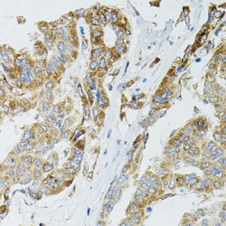 Sirtuin 3 (SIRT3) Antibody