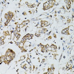 Sirtuin 3 (SIRT3) Antibody