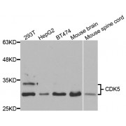 Western blot analysis of extracts of various cell lines, using CDK5 antibody (abx004382) at 1/1000 dilution.