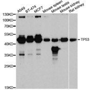 Western blot analysis of extracts of various cell lines, using TP53 antibody (abx004409) at 1:6000 dilution.