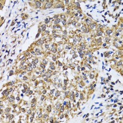 Cellular Tumor Antigen P53 (TP53) Antibody