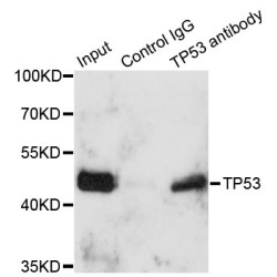 Cellular Tumor Antigen P53 (TP53) Antibody