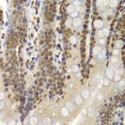 SWI/SNF-Related Matrix-Associated Actin-Dependent Regulator of Chromatin Subfamily B Member 1 (SMARCB1) Antibody