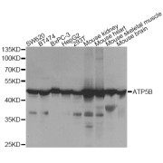 Western blot analysis of extracts of various cell lines, using ATP5B Antibody (abx004417) at 1/1000 dilution.