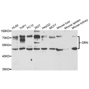 Western blot analysis of extracts of various cell lines, using GRN antibody (abx004421) at 1/1000 dilution.