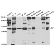 Western blot analysis of extracts of various cell lines, using PNP antibody (abx004426) at 1/1000 dilution.