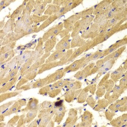 Peroxisomal Biogenesis Factor 5 (PEX5) Antibody