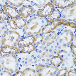 Peroxisomal Biogenesis Factor 5 (PEX5) Antibody